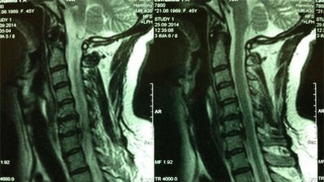 MRI of the cervix department